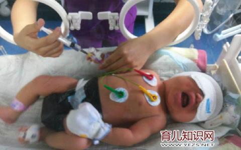 新生宝宝输液有危害吗 新生婴儿输液的危害