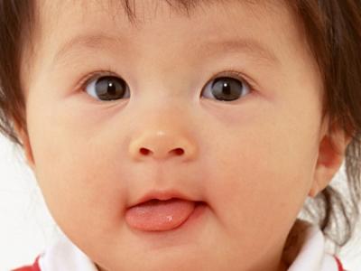 眼屎多是不是结膜炎 宝宝有眼屎警惕新生儿结膜炎