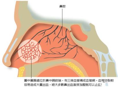 鼻子外面出血怎么回事 鼻子出血时怎么办