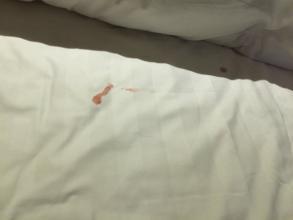 床单上的血迹怎么洗 床单上的血迹怎么洗干净