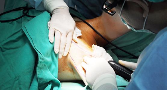 腋臭手术方法有哪些 哪些人不适宜做腋臭手术？