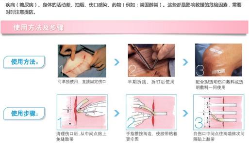 剖宫产疤痕修复 剖宫产疤痕修复要注意什么