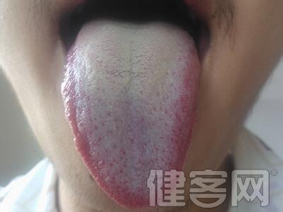 泡脚有助于癌症扩散 清洁舌苔有助于预防癌症