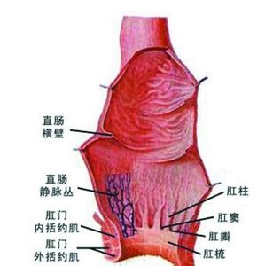 痔疮患病率 引起痔疮患病的原因有哪些?