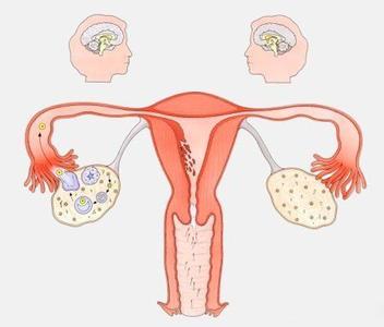 功能失调性子宫出血 更年期功能失调性子宫出血病方四