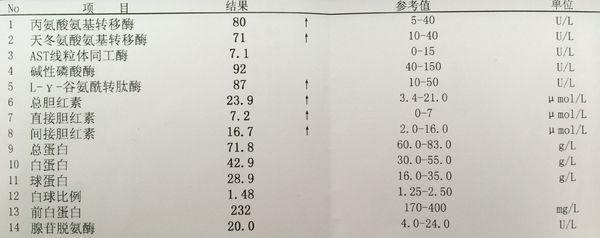 肝功能异常病因 什么是肝功能异常 肝功能异常病因 肝功能异常治疗建议