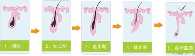 金钱麻怎么迅速生长 怎么样才能让头发迅速生长