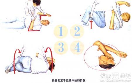 高血压急救手指放血 高血压急救方法