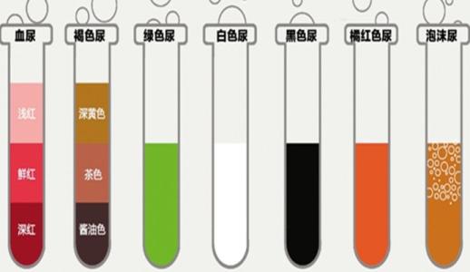 尿液的颜色与健康程度 看尿液颜色知健康危机(2)