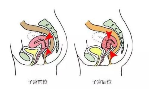 保护环境要做到哪几点 保护子宫必须做到哪“三不”