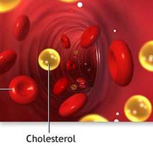 胆固醇正常值是多少 胆固醇