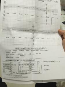 新生儿脑缺氧如何治疗 如何诊断新生儿缺氧