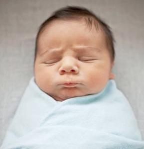 新生儿胎毒的症状图片 胎毒是什么