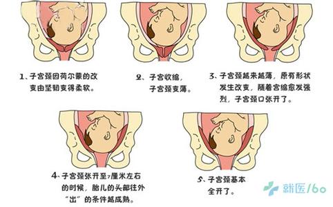 内力作用的表现形式 什么是宫缩 宫缩表现形式 宫缩作用 宫缩缓解方法