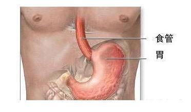 胃癌手术后能活几年 胃癌的早期症状有哪些