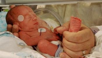 新生儿脑缺氧会自愈么 新生儿脑缺氧怎么办
