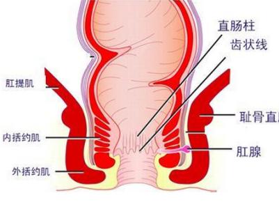 肛门湿疹怎么治疗最好 肛门湿疹是怎么回事