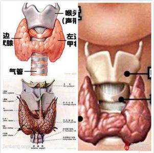 甲状腺结节的早期症状 甲状腺结节的常见早期症状都有哪些