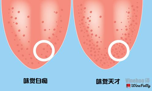 心理健康程度测试 从舌头测试你的健康程度