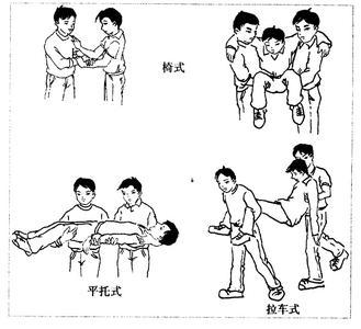 骨折急救 骨折急救时应该怎么做