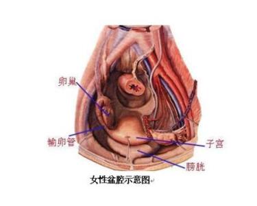 盆腔炎的危害 为什么会得盆腔炎？盆腔炎给女性带来的5大危害(2)