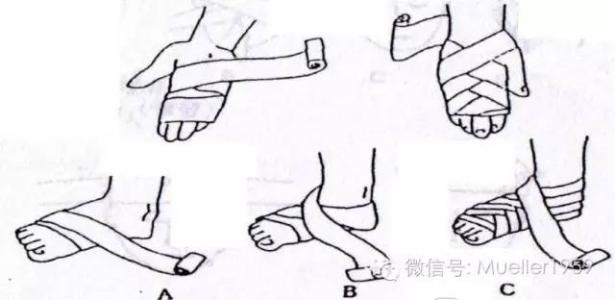 运动损伤的急救方法 运动损伤急救方法