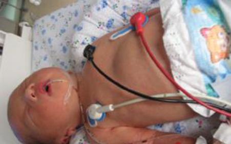 新生儿窒息急救流程图 新生儿窒息的急救护理