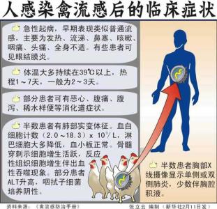 禽流感2017有哪些症状 2017年禽流感发病症状