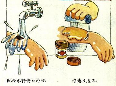烫伤急救 高温烫伤急救
