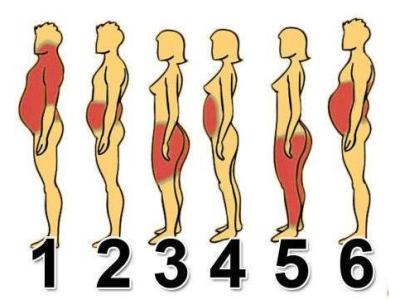 肥胖有几种类型 你属于哪种肥胖类型