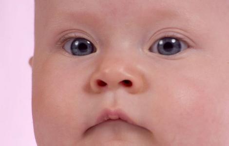 新生儿脸上有小红斑点 新生儿脸上有小红点怎么办