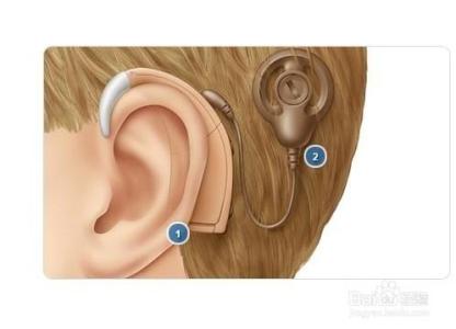 老年人怎样选购助听器 怎样选购助听器