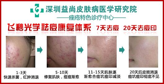 上海哪些治疗皮肤病 治疗皮肤病有哪些标准