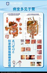 胃病咨询 胃病知识咨询