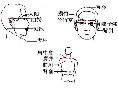 怎样按摩背部缓解疲劳 缓解疲劳的穴位