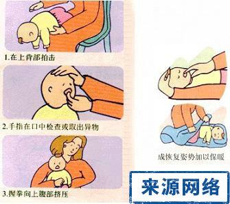 婴儿呛奶急救方法图片 婴儿急救常识