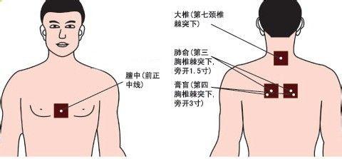 小儿三伏贴的作用 三伏贴的作用