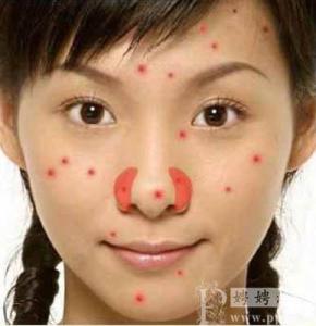 如何祛除脸上的痘痘 多吃菊花草莓祛除脸上痘痘