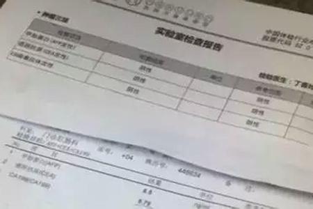 风湿四项检查多少钱 心脏健康检查主要看四项