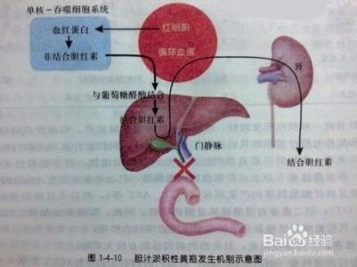 胆固醇高吃什么药最好 胆固醇高的原因