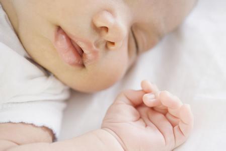 宝宝口角炎怎么办 宝宝口角炎怎么预防