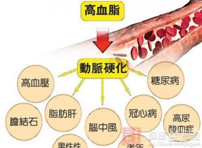 高血脂吃什么好降血脂 高血脂是什么