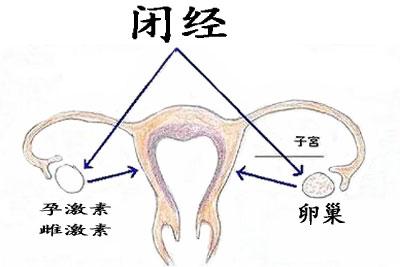 闭经的原因和危害 闭经的原因及危害有哪些