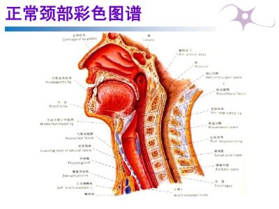 如何防治颈椎病 如何有效防治颈椎病