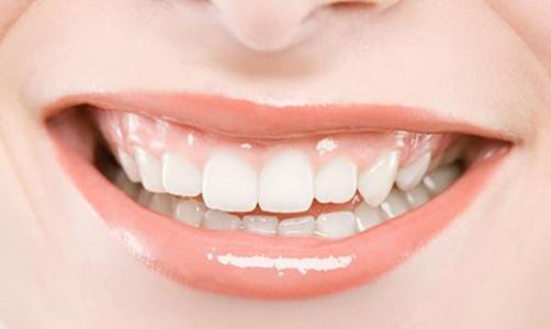 孕妇牙龈出血怎么缓解 牙龈出血要如何缓解