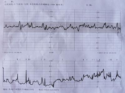 胎心监护不好说明什么 胎心监护的作用