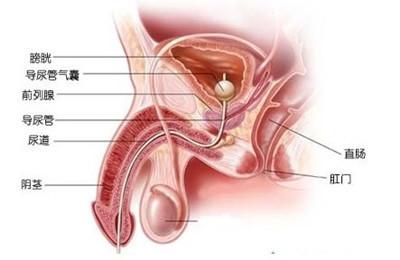 前列腺增生伴结石 前列腺增生伴结石的治疗方法
