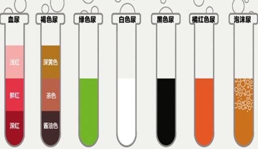 尿液的颜色与健康程度 尿液颜色辨健康