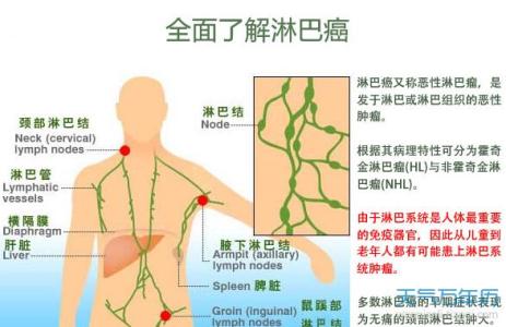 世界淋巴瘤日 世界淋巴瘤日是几月几日