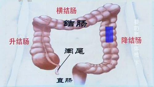 直肠癌的起因 直肠癌的起因对你来说有多重要